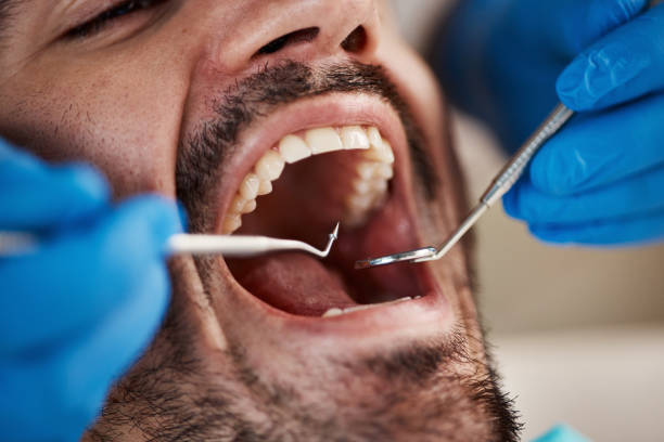 Best Urgent Tooth Repair  in Clarksville, TN