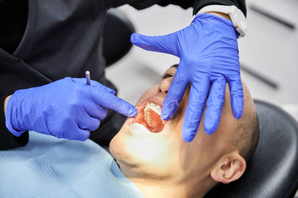 Best Dentist for Tooth Abscess  in Clarksville, TN